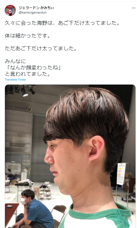 ジェラードン海野イケメンで性格に難ありとウワサが アゴの病気はどうなった お笑いエンタメ情報